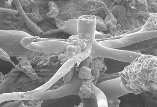 Illustration for article titled Tentacled Fungus Attacks The Microverse